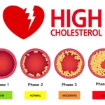 7 Cara Menurunkan Kolesterol Tinggi Secara Alami dan Efektif