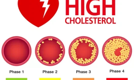 7 Cara Menurunkan Kolesterol Tinggi Secara Alami dan Efektif