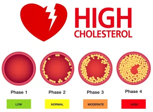 7 Cara Menurunkan Kolesterol Tinggi Secara Alami dan Efektif