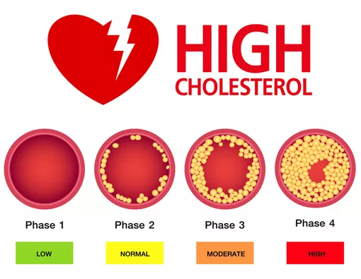 7 Cara Menurunkan Kolesterol Tinggi Secara Alami dan Efektif